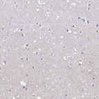 Immunohistochemical staining of human cerebral cortex shows no positivity in neurons as expected.