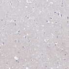 Immunohistochemical staining of human cerebral cortex shows no positivity in neurons as expected.