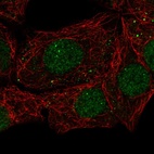 Anti-EAF1 Antibody