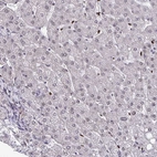 Immunohistochemical staining of human liver shows no positivity in hepatocytes as expected.