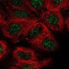 Immunofluorescent staining of human cell line MCF7 shows positivity in nucleus but excluded from the nucleoli.