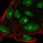 Immunofluorescent staining of human cell line RT4 shows localization to nucleus & nucleoli.