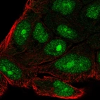 Immunofluorescent staining of human cell line RT4 shows localization to nucleus & nucleoli.