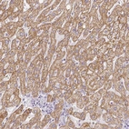 Anti-ZNF280B Antibody