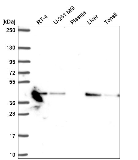 Anti-NDUFA10 Antibody