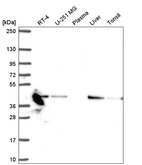 Anti-NDUFA10 Antibody
