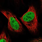 Immunofluorescent staining of human cell line U-2 OS shows localization to nucleoplasm.