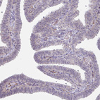 Anti-MUS81 Antibody