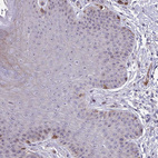 Immunohistochemical staining of human skin shows weak nucleolar positivity in squamous epithelial cells.
