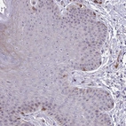 Immunohistochemical staining of human skin shows weak nucleolar positivity in squamous epithelial cells.