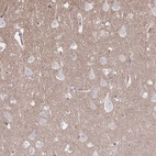 Immunohistochemical staining of human cerebral cortex shows weak nucleolar positivity in neurons.