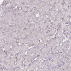 Immunohistochemical staining of human liver shows no positivity in hepatocytes as expected.