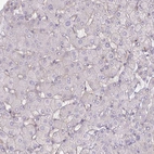 Immunohistochemical staining of human liver shows no positivity in hepatocytes as expected.