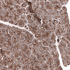 Anti-IGFBP2 Antibody