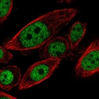 Immunofluorescent staining of human cell line PC-3 shows localization to nucleoplasm.