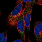 Immunofluorescent staining of human cell line RH-30 shows localization to vesicles.
