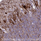 Anti-TMEM189 Antibody