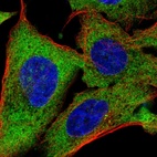 Immunofluorescent staining of human cell line U-2 OS shows localization to endoplasmic reticulum.