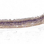 Anti-RS1 Antibody