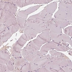 Immunohistochemical staining of human skeletal muscle shows no positivity in myocytes as expected.