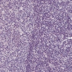 Immunohistochemical staining of human tonsil shows no positivity in lymphoid cells as expected.