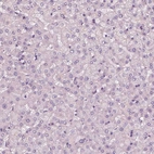 Immunohistochemical staining of human liver shows no positivity in hepatocytes as expected.