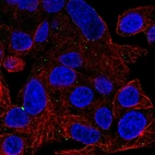 Immunofluorescent staining of human cell line Hep G2 shows localization to vesicles.