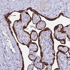 Anti-PRDM9 Antibody