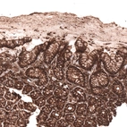 Immunohistochemical staining of human stomach shows strong membranous positivity in glandular cells.