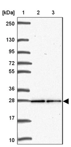 Lane 1: Marker [kDa] 250, 130, 95, 72, 55, 36, 28, 17, 10_br/_Lane 2: Human cell line RT-4_br/_Lane 3: Human cell line U-251MG sp