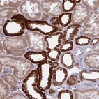 Anti-KCNJ16 Antibody