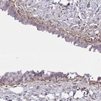 Anti-SLC14A1 Antibody