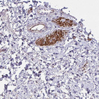 Anti-SLC14A1 Antibody