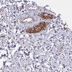 Immunohistochemical staining of human urinary bladder shows strong cytoplasmic positivity in erythrocytes.