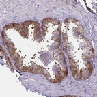 Immunohistochemical staining of human prostate shows moderate membranous positivity in glandular cells.