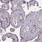 Immunohistochemical staining of human placenta shows moderate cytoplasmic positivity in endothelial cells.