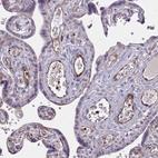 Immunohistochemical staining of human placenta shows moderate cytoplasmic positivity in endothelial cells.