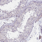 Immunohistochemical staining of human testis shows no positivity in cells in seminiferous ducts as expected.