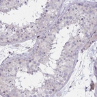 Immunohistochemical staining of human testis shows no positivity in cells in seminiferous ducts as expected.