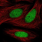 Immunofluorescent staining of human cell line SiHa shows localization to nucleoplasm.