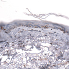 Immunohistochemical staining of human skin shows negative to weak positivity in squamous epithelial cells.