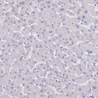 Immunohistochemical staining of human liver shows no positivity in hepatocytes as expected.