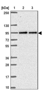 Anti-TTC7B Antibody