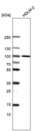 Western blot analysis in human cell line HDLM-2.