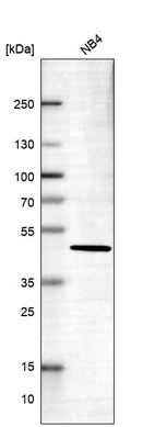 Western blot analysis in human cell line NB4.