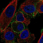 Immunofluorescent staining of human cell line PC-3 shows localization to plasma membrane.
