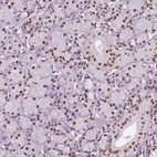 Anti-DDX3X Antibody