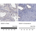 Anti-DDX3Y Antibody