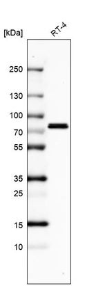 Western blot analysis in human cell line RT-4.