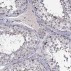 Immunohistochemical staining of human testis shows high expression.